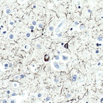 Tau (Tau 46) Antibody