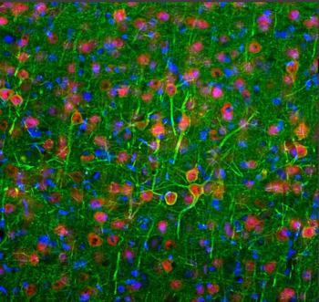 Neurofilament NF-L Antibody