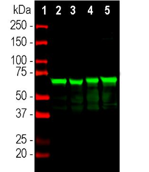 Neurofilament NF-L Antibody