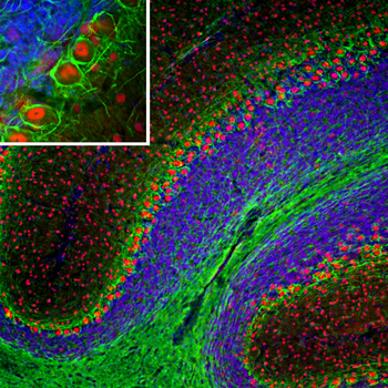 Neurofilament NF-L Antibody