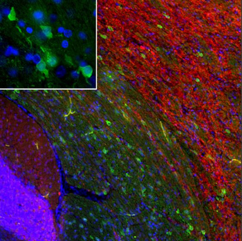 PEA-15 Antibody