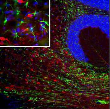 PEA-15 Antibody