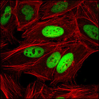 c-Jun Antibody