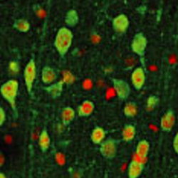 phospho-Tyrosine Hydroxylase (Ser40) Antibody