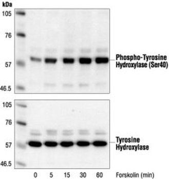 phospho-Tyrosine Hydroxylase (Ser40) Antibody