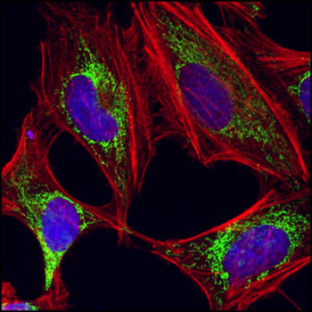 HSP60 (D85) Antibody