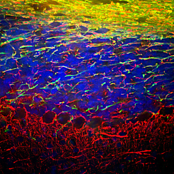 Neurofilament NF-L Antibody