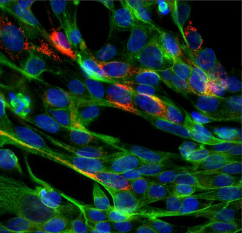 SARS-CoV2 S-Protein ACE2 Binding Domain Antibody