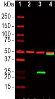 SARS-CoV2 S-Protein ACE2 Binding Domain Antibody