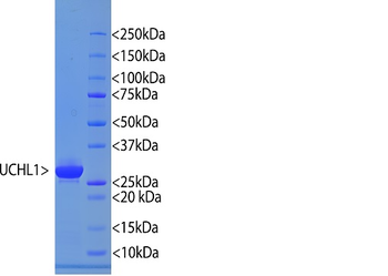 Human UCHL1 Protein