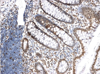 Lamin A+C Monoclonal Antibody