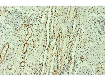 hnRNP F+H Monoclonal Antibody