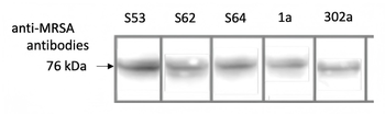 MRSA (PBP2a) Monoclonal Antibody