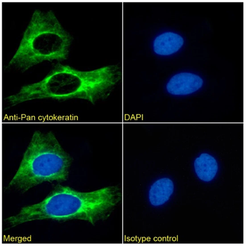 Pan Cytokeratin Monoclonal Antibody