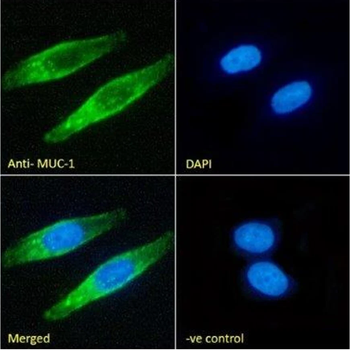 Mucin-1 Monoclonal Antibody