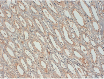Insulin-Like Growth Factor Monoclonal Antibody