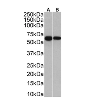 Human IgA Monoclonal Antibody