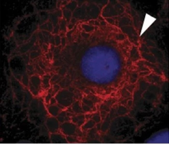 Cytokeratin 3 Antibody (FITC)
