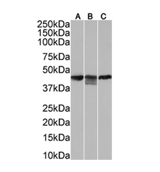 Cytokeratin 18 Monoclonal Antibody