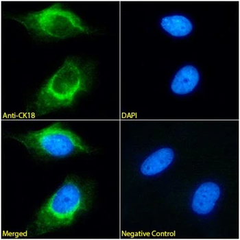 Cytokeratin 18 Monoclonal Antibody