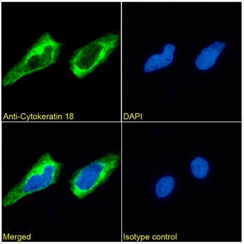 Cytokeratin 18 Monoclonal Antibody