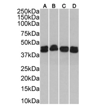 Cytokeratin 18 Monoclonal Antibody