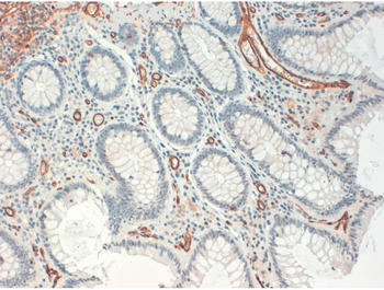 CD34 Monoclonal Antibody