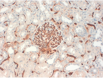 CD34 Monoclonal Antibody