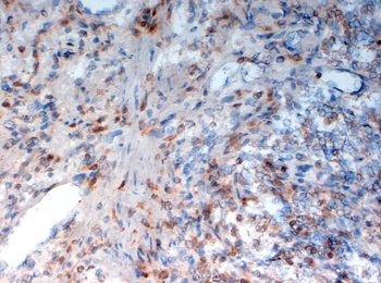 CD33 Monoclonal Antibody