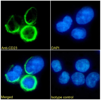 CD23 Monoclonal Antibody