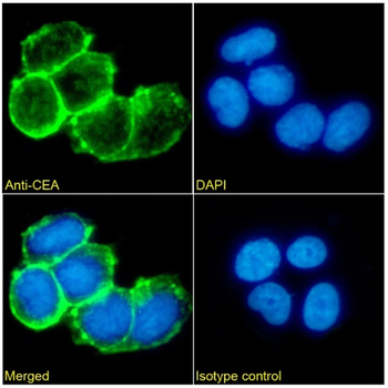 Carcino Embryonic Antigen CEA Monoclonal Antibody
