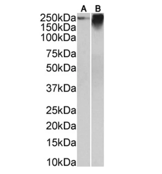 Carcino Embryonic Antigen CEA Mouse Monoclonal Antibody