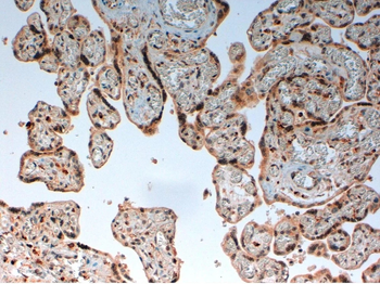 C4d Complement Monoclonal Antibody