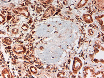 C4d Complement Monoclonal Antibody
