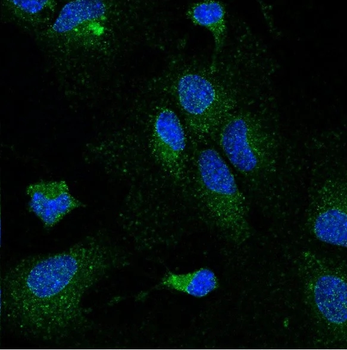 Lipoprotein Lipase Monoclonal Antibody