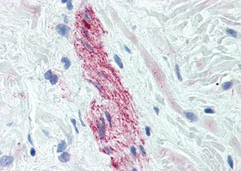 Nestin Antibody (FITC)