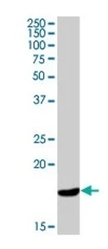 Cathelicidin Antibody (FITC)