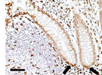 Lamin A+C Monoclonal Antibody