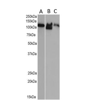 Major Vault Protein Rabbit Recombinant Antibody