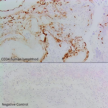 CD34 Mouse Recombinant Antibody