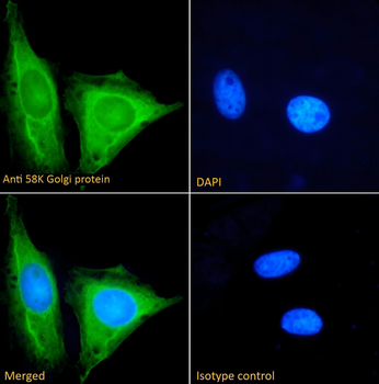 58K Golgi protein (FTCD) Antibody