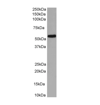 58K Golgi protein (FTCD) Antibody