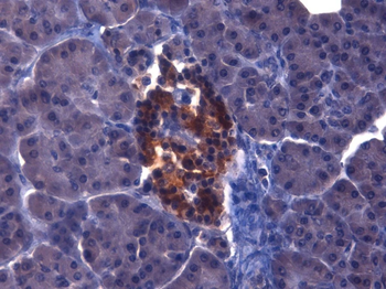Insulin-Like Growth Factor Antibody (FITC)