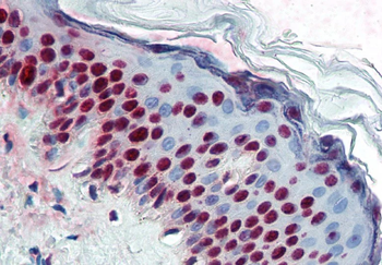 ALY/ Ref Monoclonal Antibody