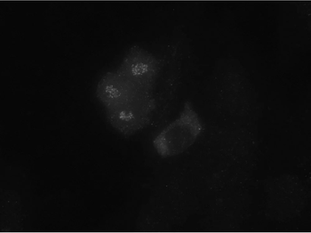 Bub1 Monoclonal Antibody
