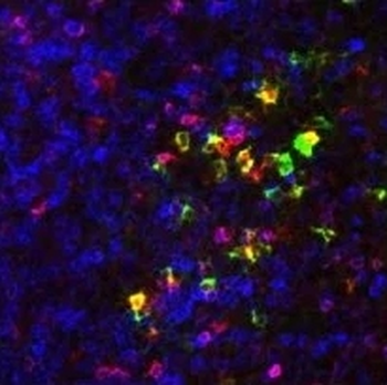 CCR9 Monoclonal Antibody