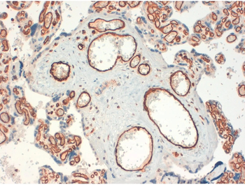 CD34 Monoclonal Antibody