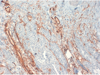 CD34 Monoclonal Antibody