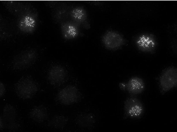 CENPE Monoclonal Antibody