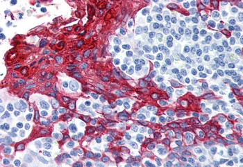 Cytokeratin 13 Monoclonal Antibody